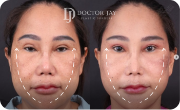 Doctor Jay Before & After gallery