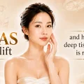 SMAS facelift and how the deep tissue layer is raised