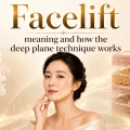 Facelift meaning and how the deep plane technique works, one of the types of facelift